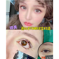 上海眼综合整形修复