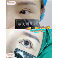 上海眼部整形修复