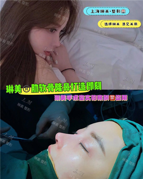 上海琳美鼻综合整形