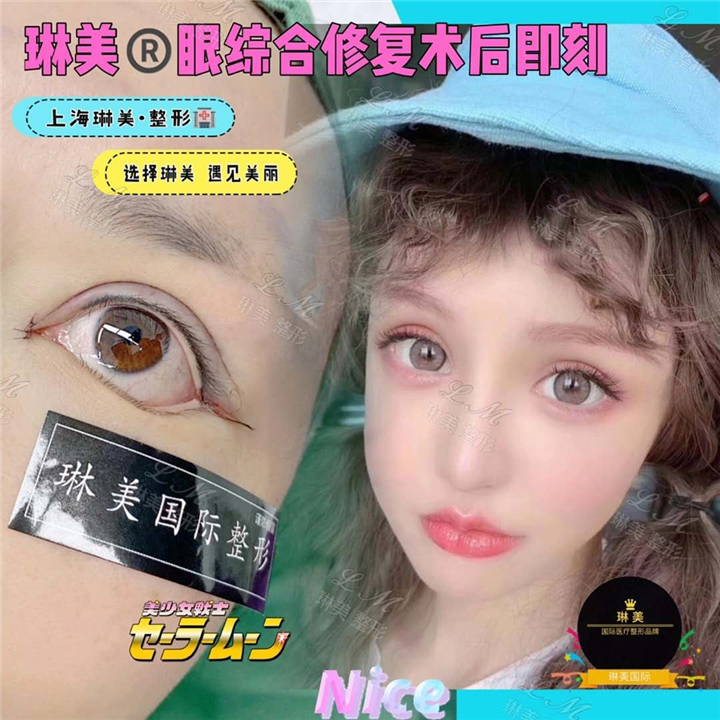 上海琳美眼综合整形