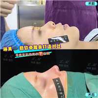 上海琳美鼻综合整形