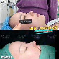 上海琳美鼻综合整形