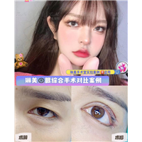 上海琳美眼综合整形