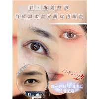 琳美眼部整形