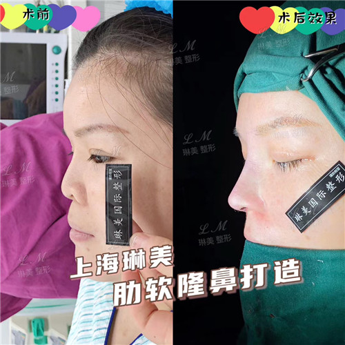 上海琳美鼻综合整形