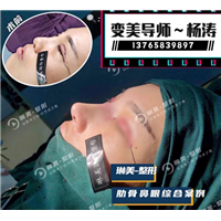琳美整形鼻综合整形 