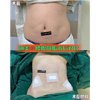上海琳美吸脂瘦身