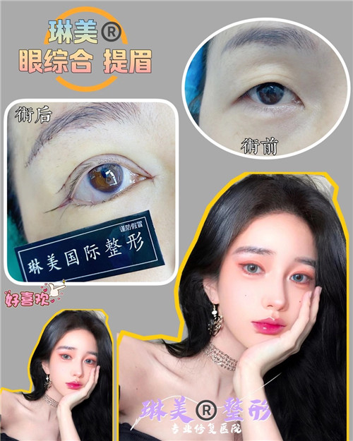上海琳美眼综合整形