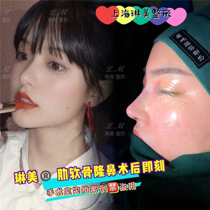 上海琳美鼻综合整形
