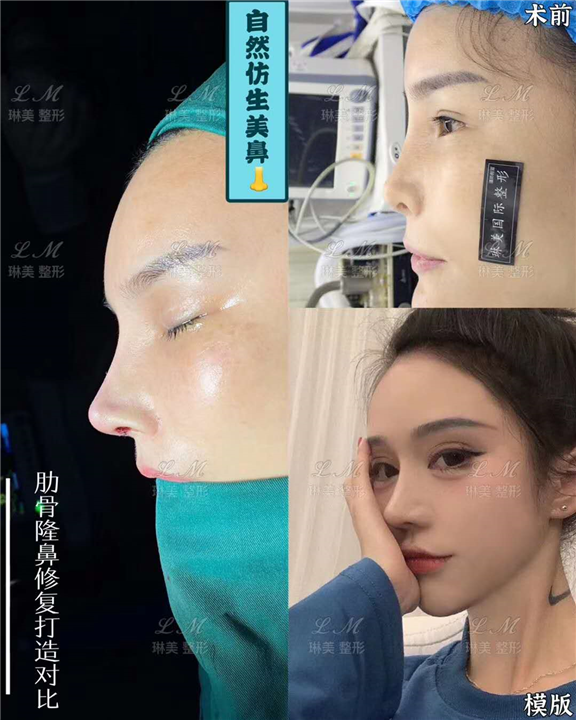 上海琳美鼻综合整形