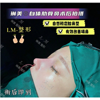 上海琳美鼻综合整形