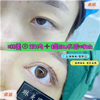 上海琳美眼综合整形