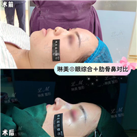 上海琳美鼻综合整形