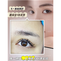 琳美整形眼综合整形 