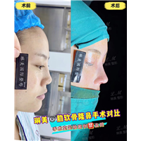 上海琳美鼻综合整形