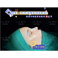 上海琳美鼻综合整形