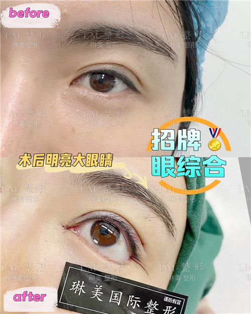 上海琳美眼综合整形