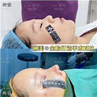上海琳美鼻综合整形