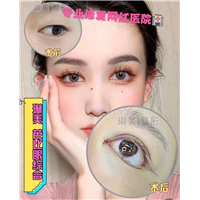 上海琳美眼综合整形