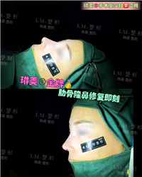 上海琳美鼻综合整形 