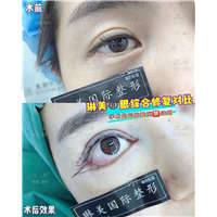 上海琳美眼综合整形