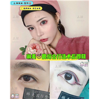 上海琳美眼综合整形