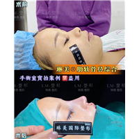 上海琳美鼻综合整形