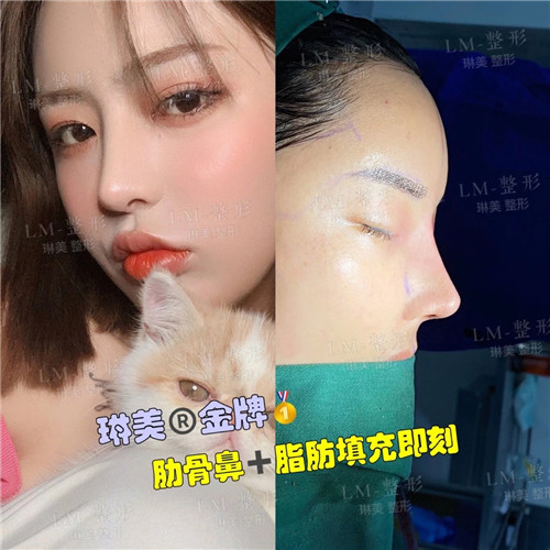 上海琳美鼻综合整形
