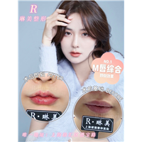 琳美唇部整形