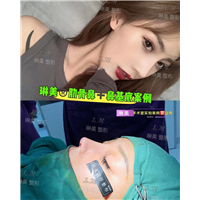 上海琳美鼻综合整形