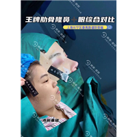 琳美整形鼻综合整形 