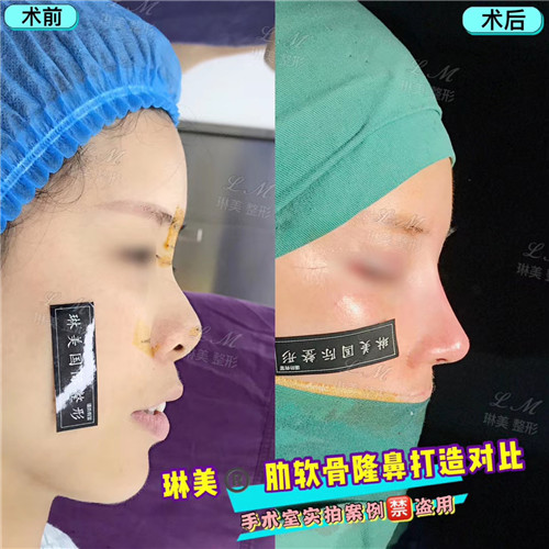 上海琳美鼻综合整形