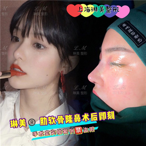 上海琳美鼻综合整形