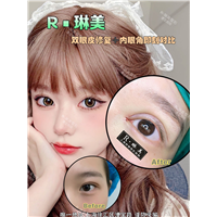 上海琳美眼综合整形