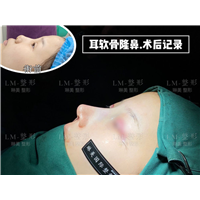 上海琳美鼻综合整形