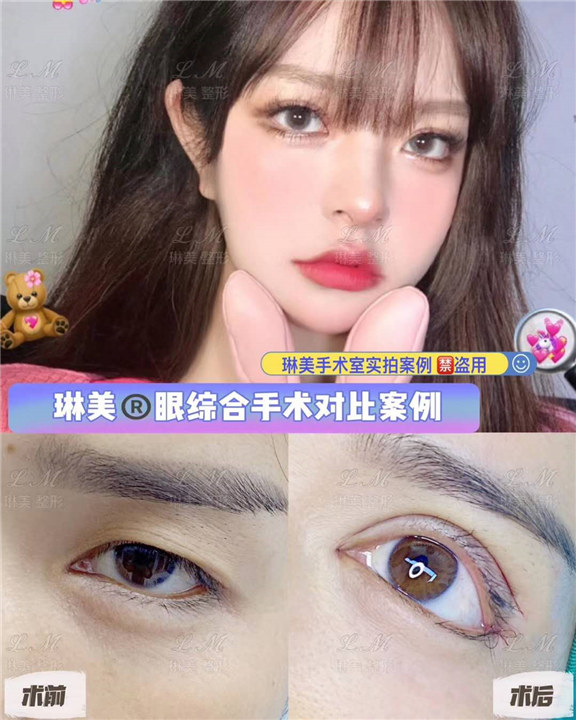上海琳美眼综合整形