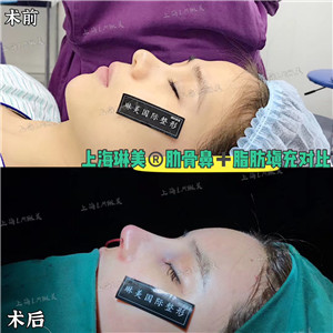 上海琳美鼻综合整形