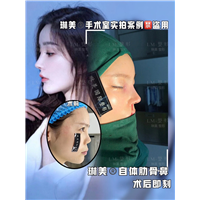 上海琳美鼻综合整形