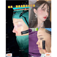 上海琳美鼻综合整形