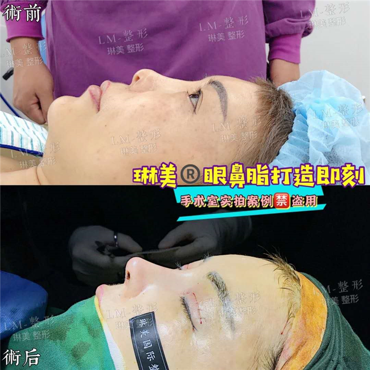 上海琳美鼻综合整形