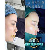 上海琳美鼻综合整形