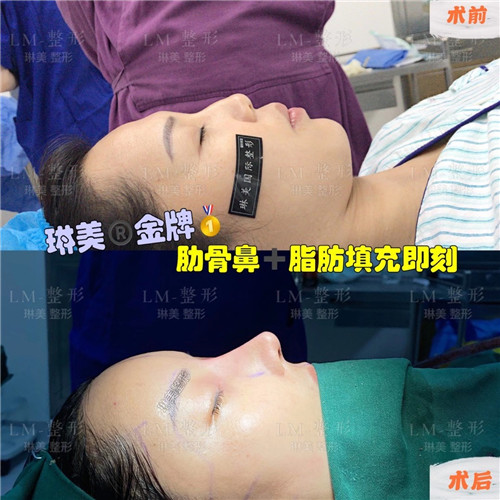 上海琳美鼻综合整形