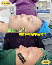 上海琳美鼻综合整形 