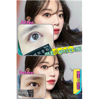上海琳美眼综合整形