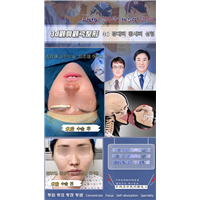 琳美磨骨整形
