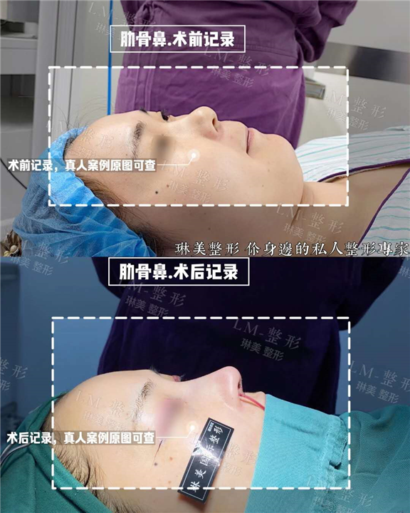 上海琳美鼻综合整形