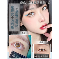 上海琳美眼综合整形