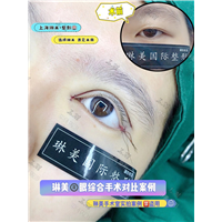 上海琳美眼综合整形