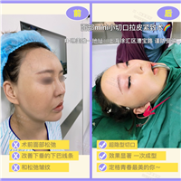 上海人气网红整形 