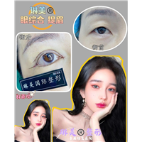 上海琳美眼综合整形